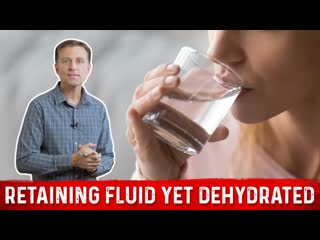 Retaining Fluid Yet Dehydrated  Dr. Berg