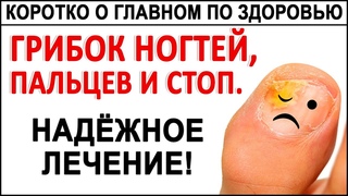 ГРИБОК НОГТЕЙ. 100%-е избавление от грибка ногтей, стоп, ног! Простой метод ДЛЯ ВСЕХ!
