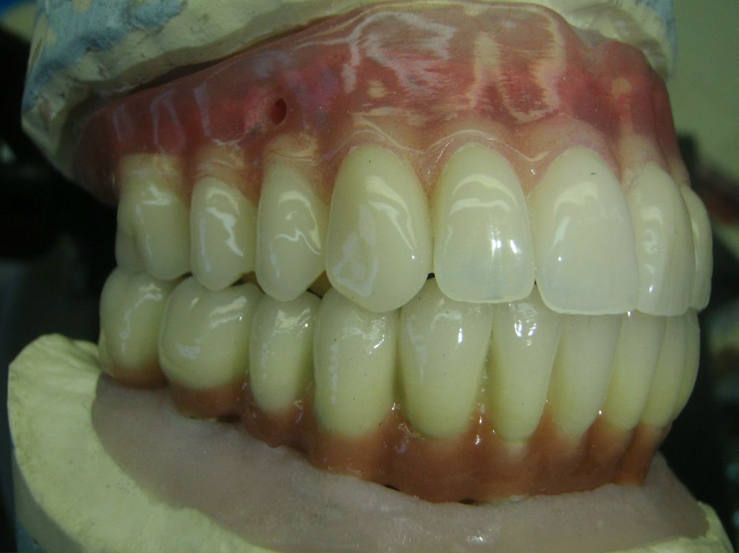 Эрнест Абрамян | Москва