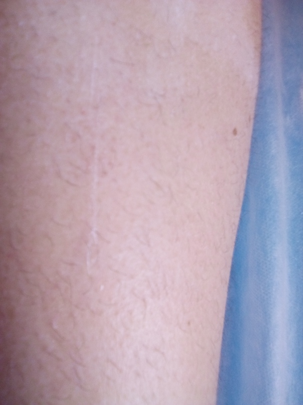 Екатерина Азарова | Волоконовка