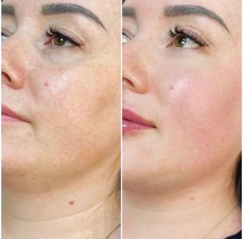 Тканевая 3D-маска Etude organix MOJITO для жирной и комбинированной кожи лица -