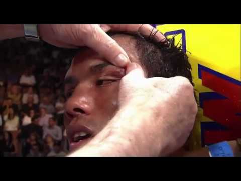 Jose Luis Castillo vs Diego